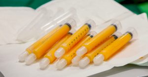 Rejuvenecimiento facial con grasa propia2