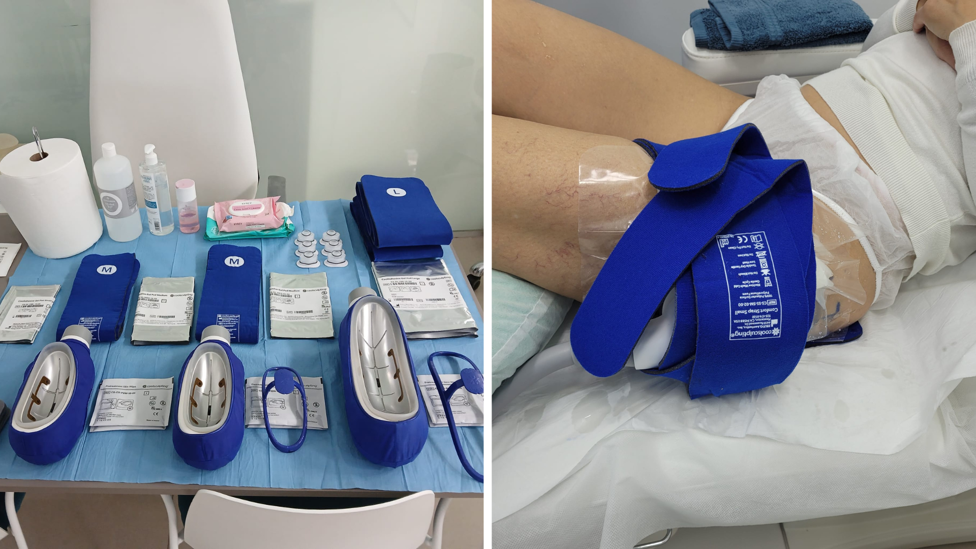 alternativa a la liposucción de muslos